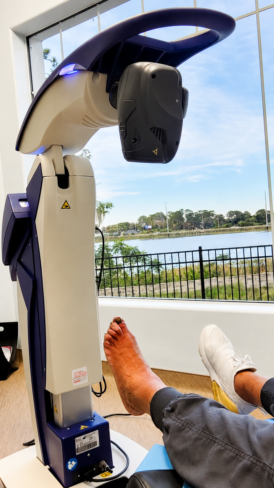 MLS laser device being used during a foot treatment session