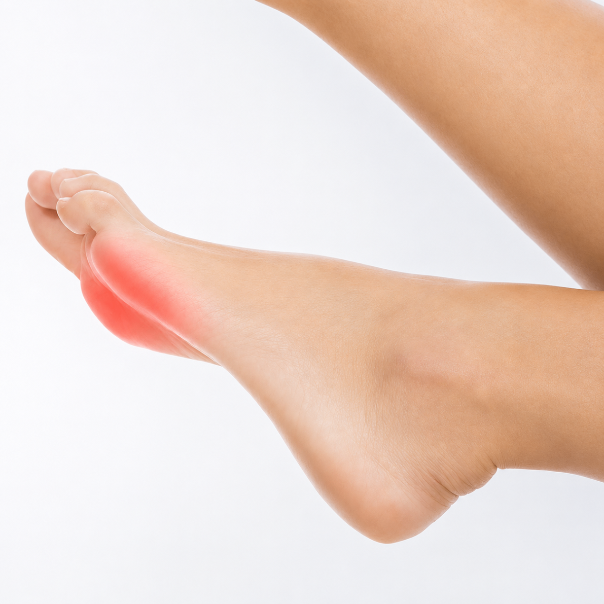 Metatarsalgia forefoot pain illustration